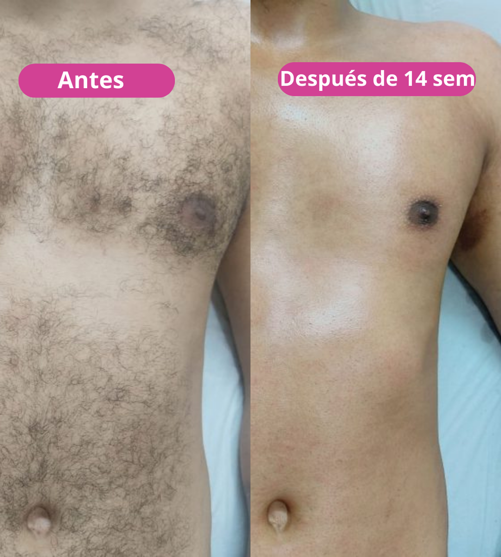 <p><strong>Amado por quienes eligieron una forma natural de reducir el vello. No te quedes fuera.</strong></p>