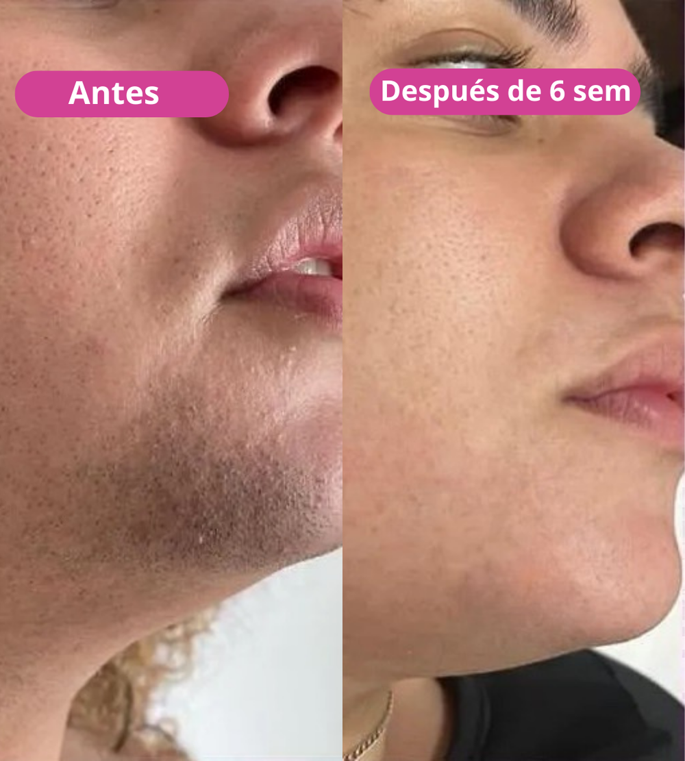 <p><strong>Amado por quienes eligieron una forma natural de reducir el vello. No te quedes fuera.</strong></p>