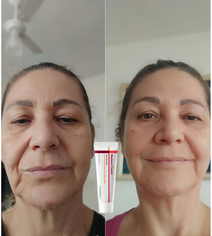 <p>Amado por quienes eligieron tratar su piel madura con respeto. </p>