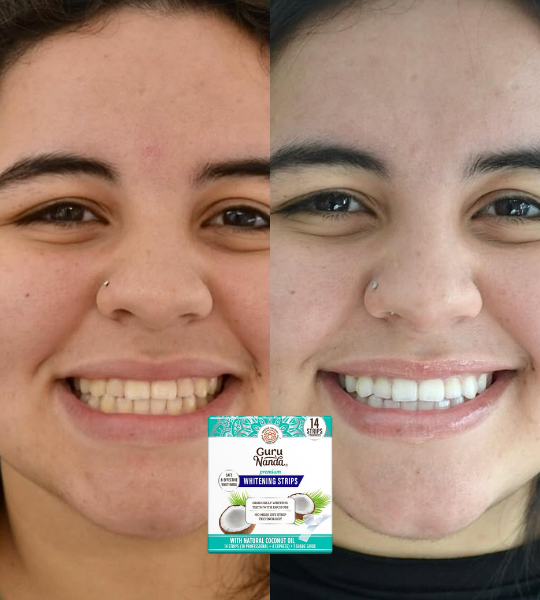 <p><strong>Amado por quienes eligieron una forma segura y gradual de aclarar sus dientes. No te quedes fuera.</strong></p>