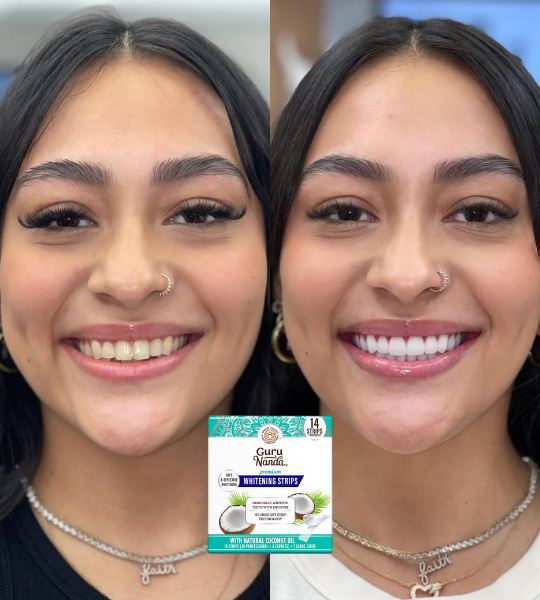 <p><strong>Amado por quienes eligieron una forma segura y gradual de aclarar sus dientes. No te quedes fuera.</strong></p>