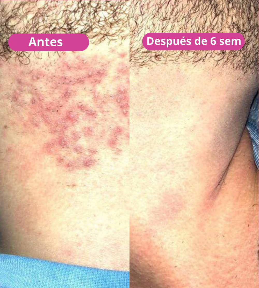 <p><strong>Amado por quienes eligieron una forma natural de reducir el vello. No te quedes fuera.</strong></p>