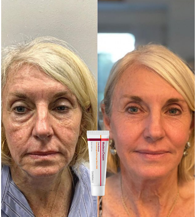 <p>Amado por quienes eligieron tratar su piel madura con respeto. </p>