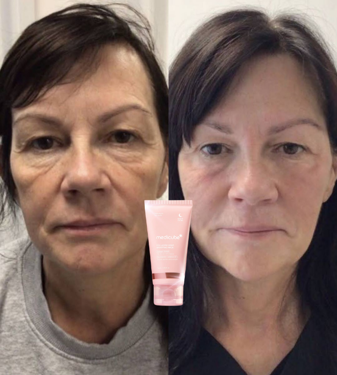 <p>Amado por quienes eligieron tratar su piel madura con respeto. </p>