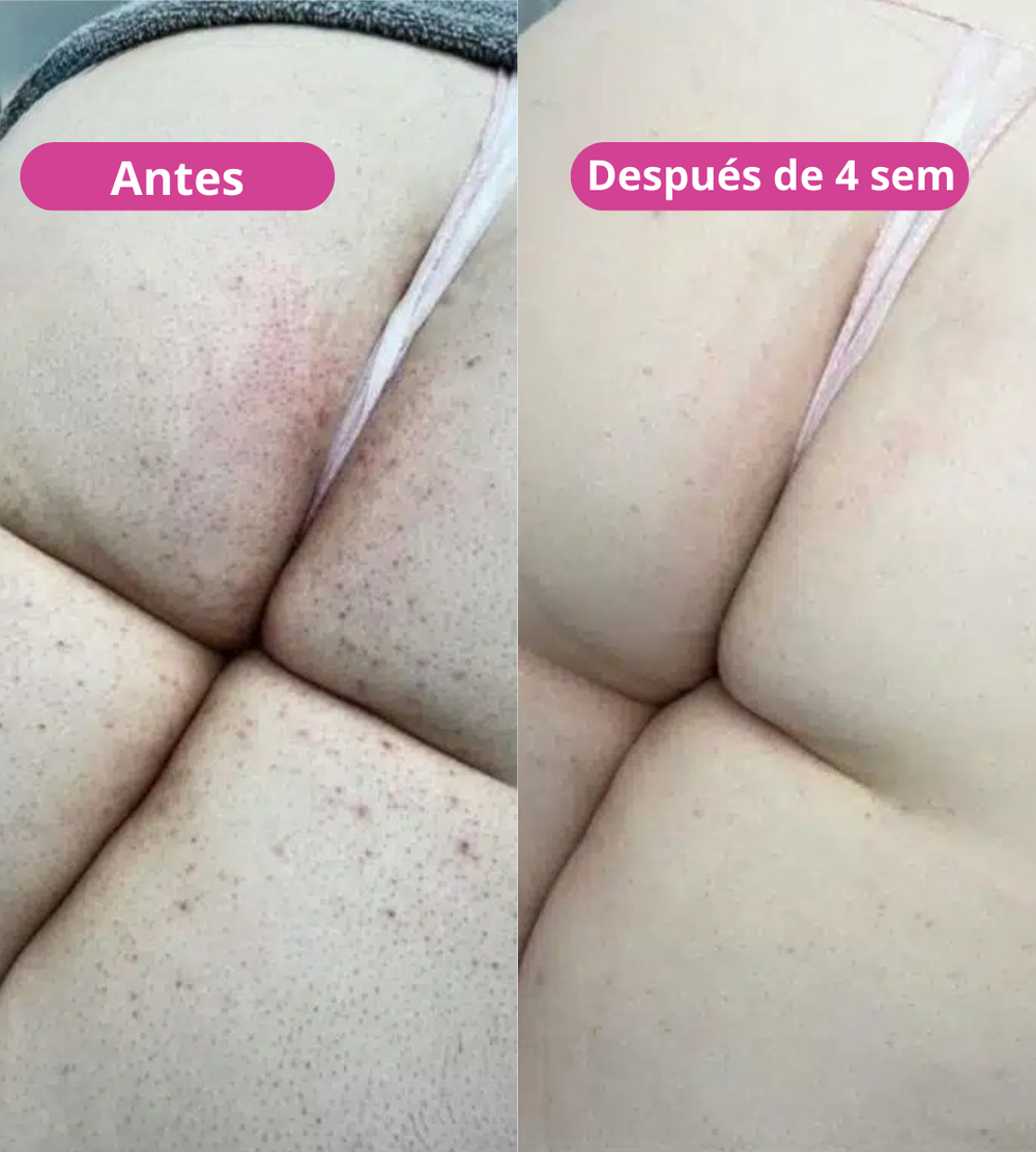 <p><strong>Amado por quienes eligieron una forma natural de reducir el vello. No te quedes fuera.</strong></p>