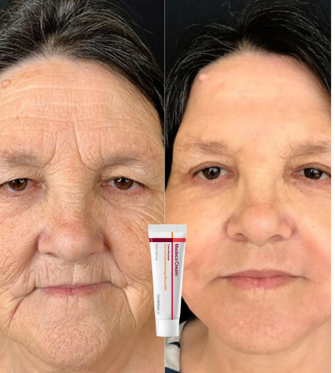 <p>Amado por quienes eligieron tratar su piel madura con respeto. </p>