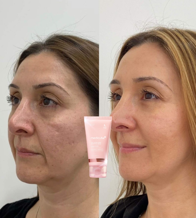 <p>Amado por quienes eligieron tratar su piel madura con respeto. </p>