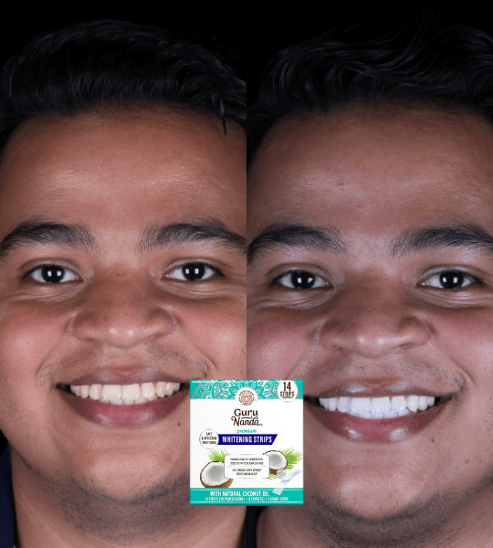 <p><strong>Amado por quienes eligieron una forma segura y gradual de aclarar sus dientes. No te quedes fuera.</strong></p>